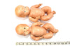 Vintage Composition Twin Baby Dolls, Molded Hair, Jointed Arms, Legs (c.1920s) - thirdshift